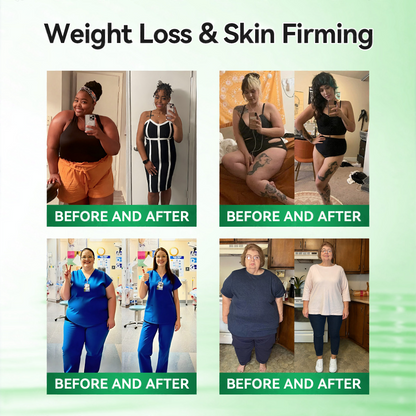 𝑶𝒇𝒇𝒊𝒄𝒊𝒂𝒍 𝑺𝒕𝒐𝒓𝒆  | 🌿curalona®𝑴𝒐𝒓𝒊𝒏𝒈𝗮 · 𝗕𝗲𝗿𝗯𝗲𝗿𝙞𝙣𝙚 × 𝙉𝘼𝐃+ 𝟏𝟎-𝐢𝐧-𝟏 𝗔𝗱𝘃𝗮𝗻𝗰𝙚𝙙 𝙉𝙖𝙣𝙤 𝙈𝙞𝙘𝙧𝙤𝙣𝙚𝙚𝐝𝐥𝐞 𝐏𝐚𝐭𝙘𝙝🇺🇸(𝐉𝐮𝐬𝐭 𝐨𝐧𝐜𝐞 𝐚 𝐝𝐚𝐲, 𝐯𝐢𝐬𝐢𝐛𝐥𝐞 𝐜𝐡𝐚𝐧𝐠𝐞𝐬 𝐢𝐧 𝟕 𝐝𝐚𝐲𝐬） ✅ 𝐅𝐨𝐫 𝐨𝐛𝐞𝐬𝐢𝐭𝐲, 🅛🅞🅞🅢🅔 🅢🅚🅘🅝,𝐝𝐢𝐚𝐛𝐞𝐭𝐞𝐬, 𝐬𝐥𝐞𝐞𝐩 𝐚𝐩𝐧𝐞𝐚, 𝐣𝐨𝐢𝐧𝐭 𝐢𝐬𝐬𝐮𝐞𝐬, 𝐚𝐧𝐝 𝐦𝐨𝐫𝐞