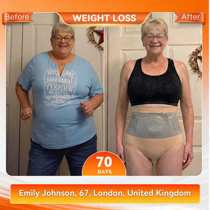 Official Brand Store | 𝓵𝓾𝓬𝓴𝔂𝓼𝓸𝓷𝓰® 2026 4-in-1 Fat-Burning & Shaping Shorts with Moringa and Berberine