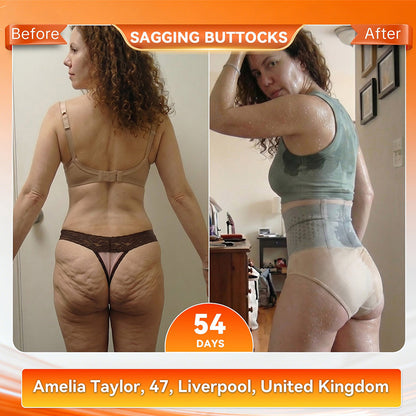 Official Brand Store | 𝓵𝓾𝓬𝓴𝔂𝓼𝓸𝓷𝓰® 2026 4-in-1 Fat-Burning & Shaping Shorts with Moringa and Berberine