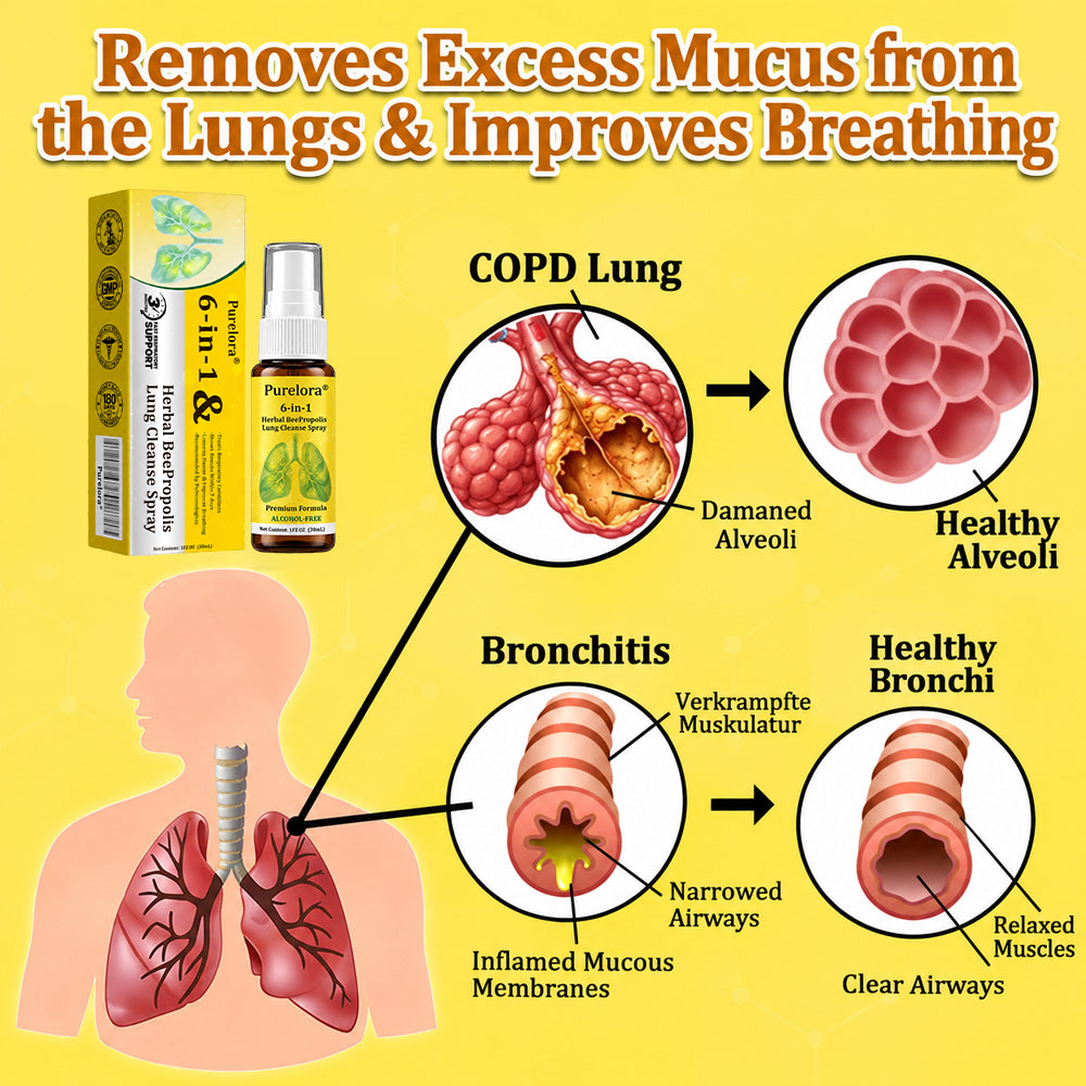 🏅🍀🐝🇬🇧 Official Store:Purelora® 6-in-1 Herbal BeePropolis Lung Cleanse Spray（👨‍⚕️Directly acts on COPD, asthma, chronic bronchitis (CB), respiratory infections, lung cancer, sinusitis, and other conditions🫁）