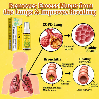 🏅🍀🐝🇬🇧 Official Store:Purelora® 6-in-1 Herbal BeePropolis Lung Cleanse Spray（👨‍⚕️Directly acts on COPD, asthma, chronic bronchitis (CB), respiratory infections, lung cancer, sinusitis, and other conditions🫁）