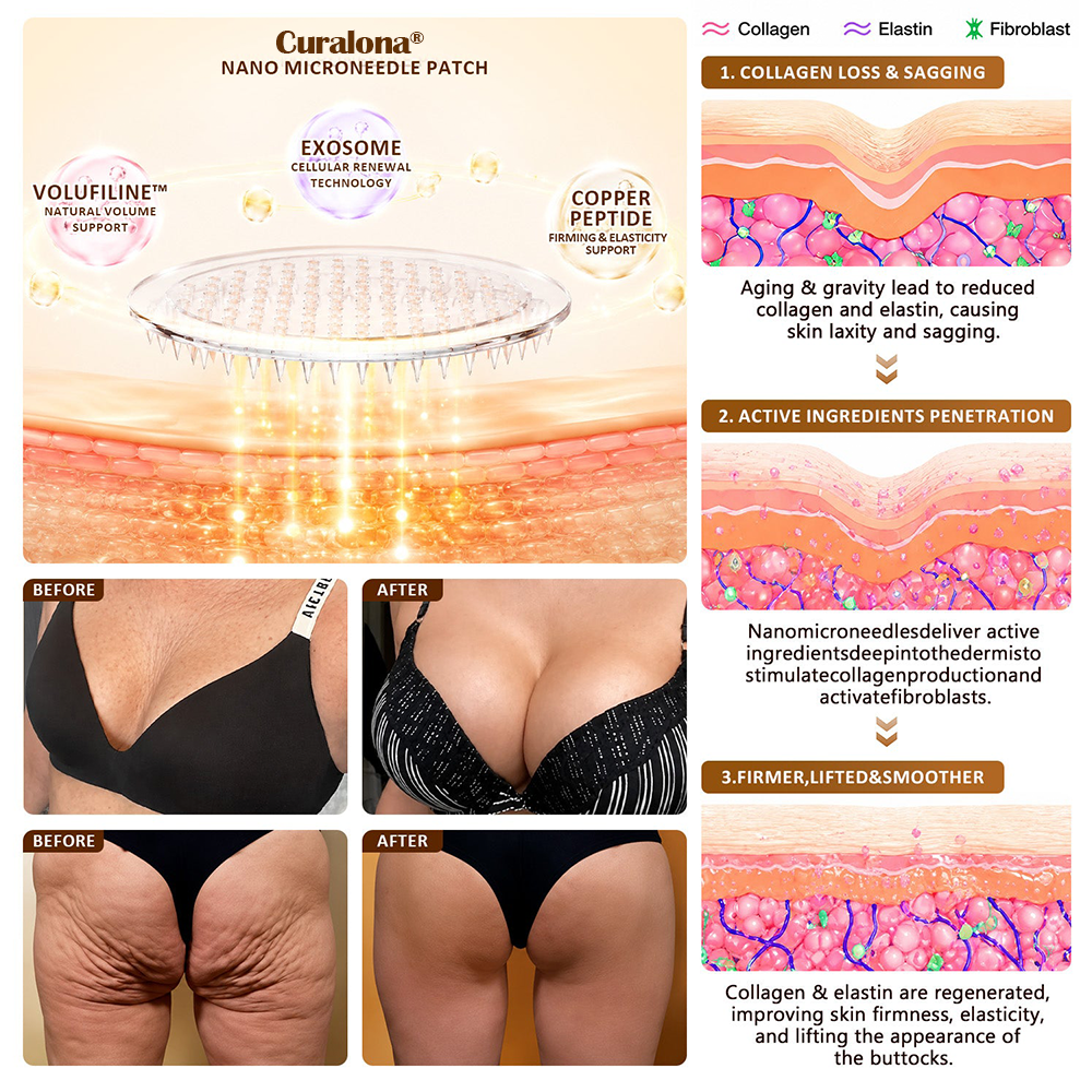 Curalona®🏆 Bust Volume, Lift & Firming Nano Microneedle Patch Volufiline + Exosome + Copper Peptide Formula Powered by Cellular Renewal Technology