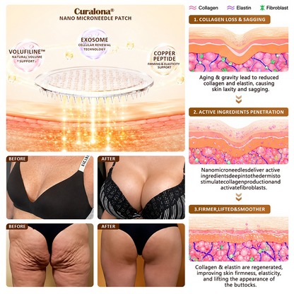Curalona®🏆 Bust Volume, Lift & Firming Nano Microneedle Patch Volufiline + Exosome + Copper Peptide Formula Powered by Cellular Renewal Technology