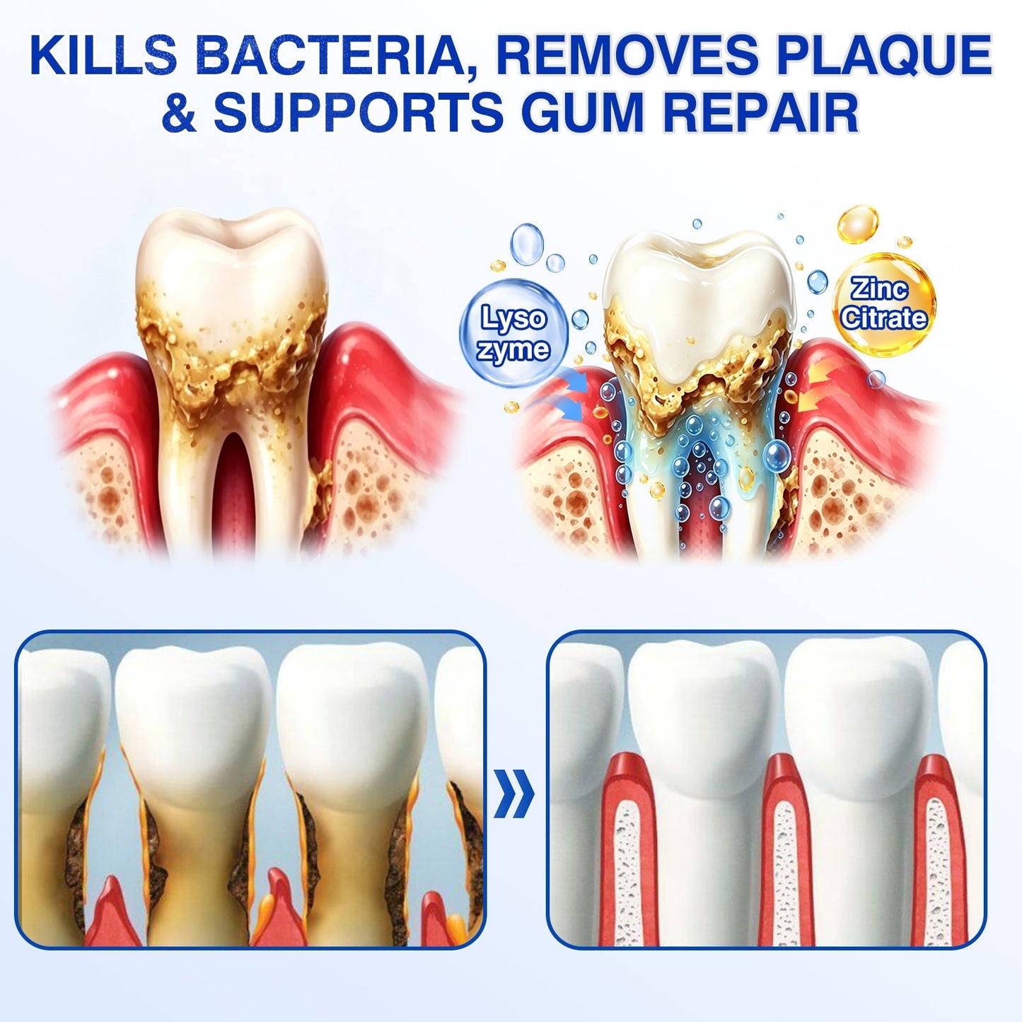🦷𝐏𝐔𝐑𝐄𝐋𝐎𝐑𝐀® GumRevive Periodontal Repair Gel (for bleeding gums, receding gums, and loose teeth)