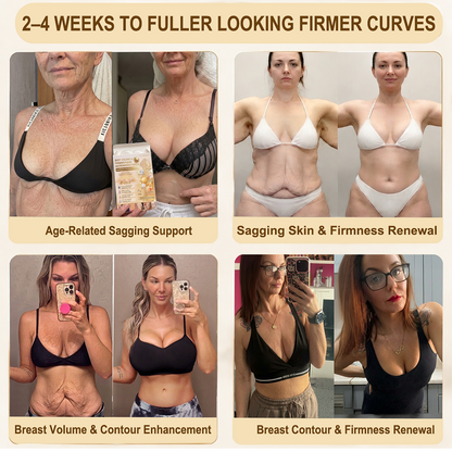Curalona®🏆 Bust Volume, Lift & Firming Nano Microneedle Patch Volufiline + Exosome + Copper Peptide Formula Powered by Cellular Renewal Technology