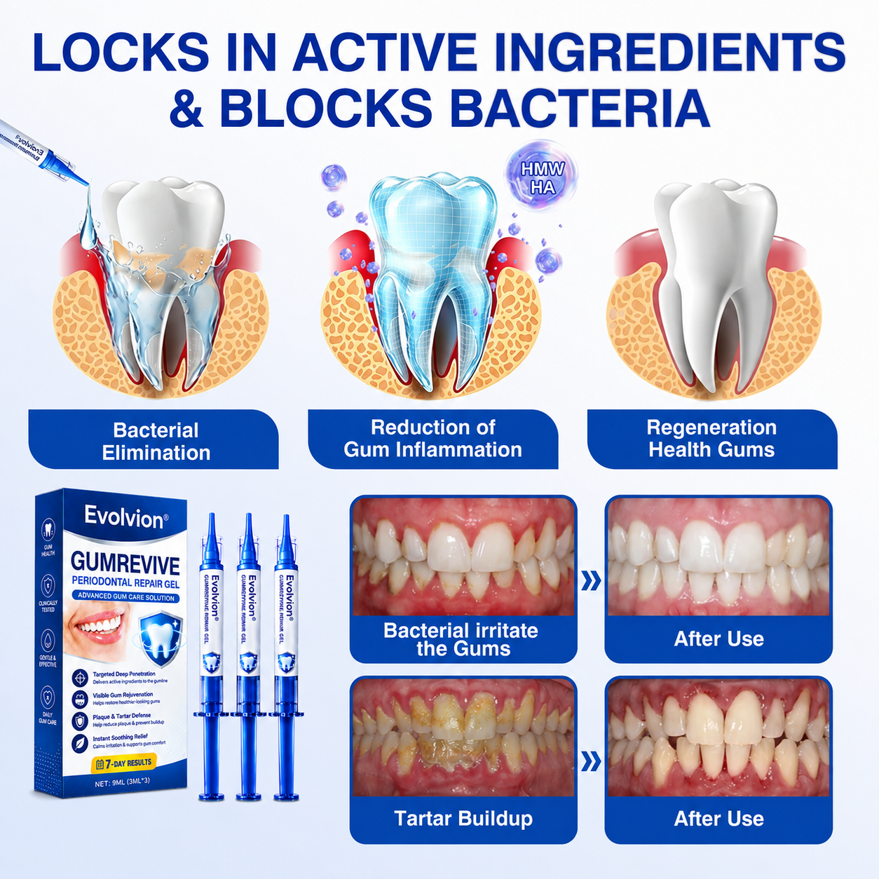 🦷𝐏𝐔𝐑𝐄𝐋𝐎𝐑𝐀® GumRevive Periodontal Repair Gel (for bleeding gums, receding gums, and loose teeth)