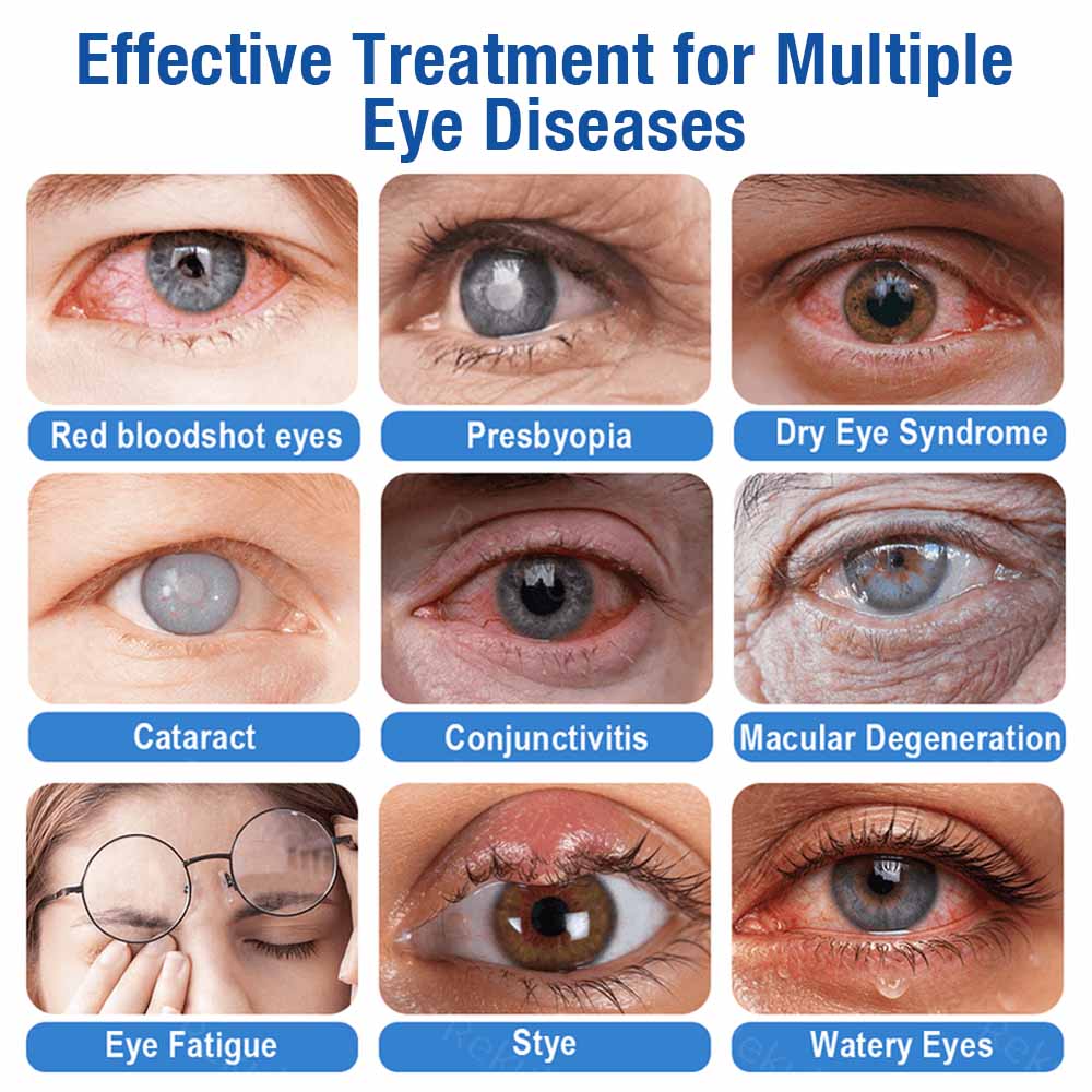 👨‍⚕️ Purelora ® LensClarity Eye Drops✅For dry eyes, blurry vision & presbyopia 💦