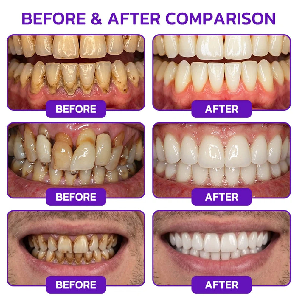Purelora® VioGum Gingivitis&Periodontal Rescue Gel