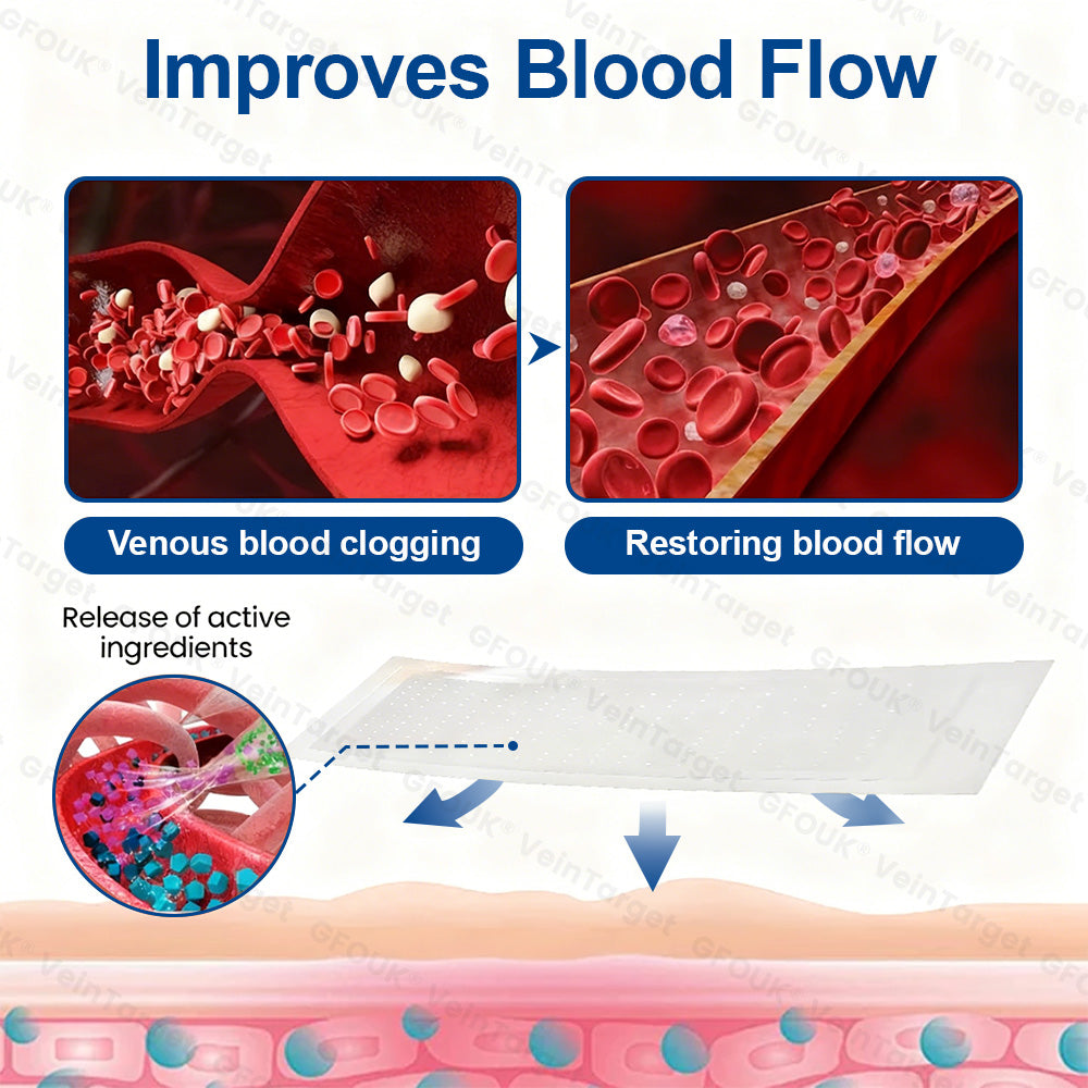 🇬🇧👨‍⚕️✨ CURALONA® VeinTarget Microneedle Patch ⚡ Fast Relief, Long-Lasting Support