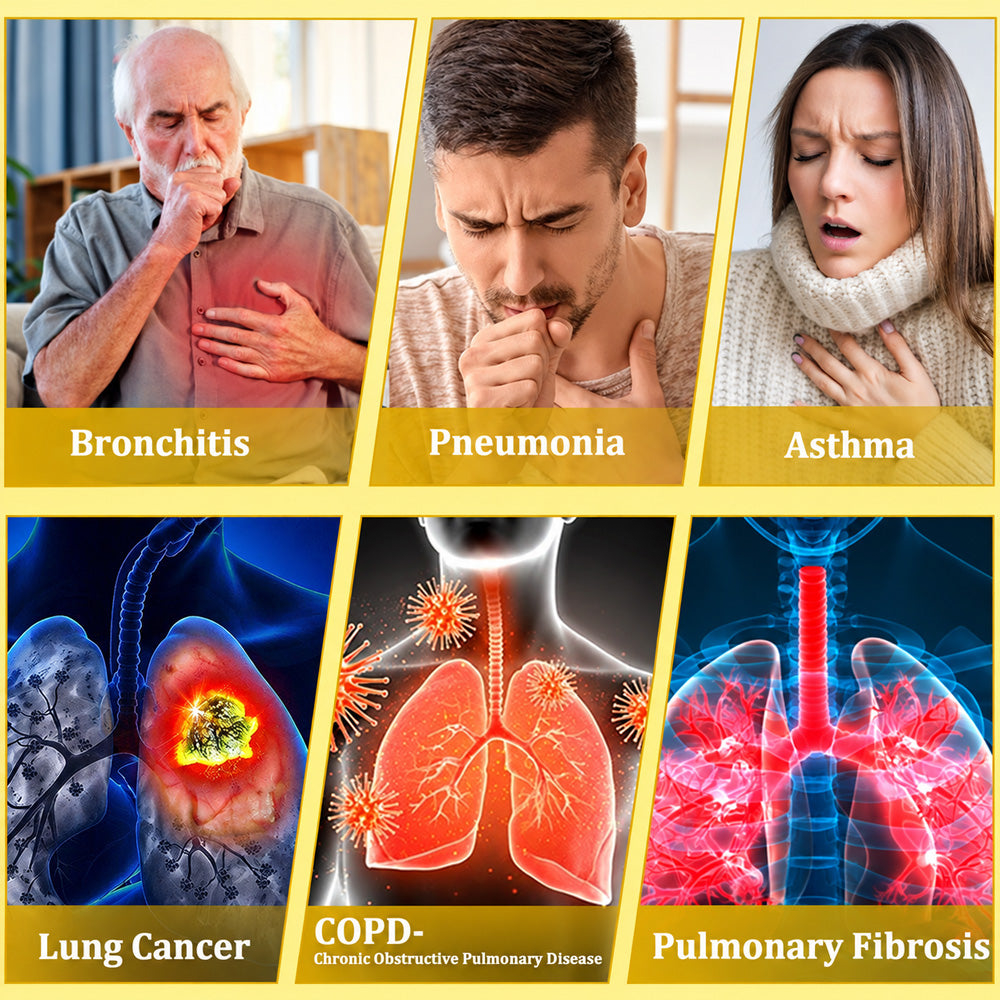 🏅🍀🐝🇬🇧 Official Store:Purelora® 6-in-1 Herbal BeePropolis Lung Cleanse Spray（👨‍⚕️Directly acts on COPD, asthma, chronic bronchitis (CB), respiratory infections, lung cancer, sinusitis, and other conditions🫁）