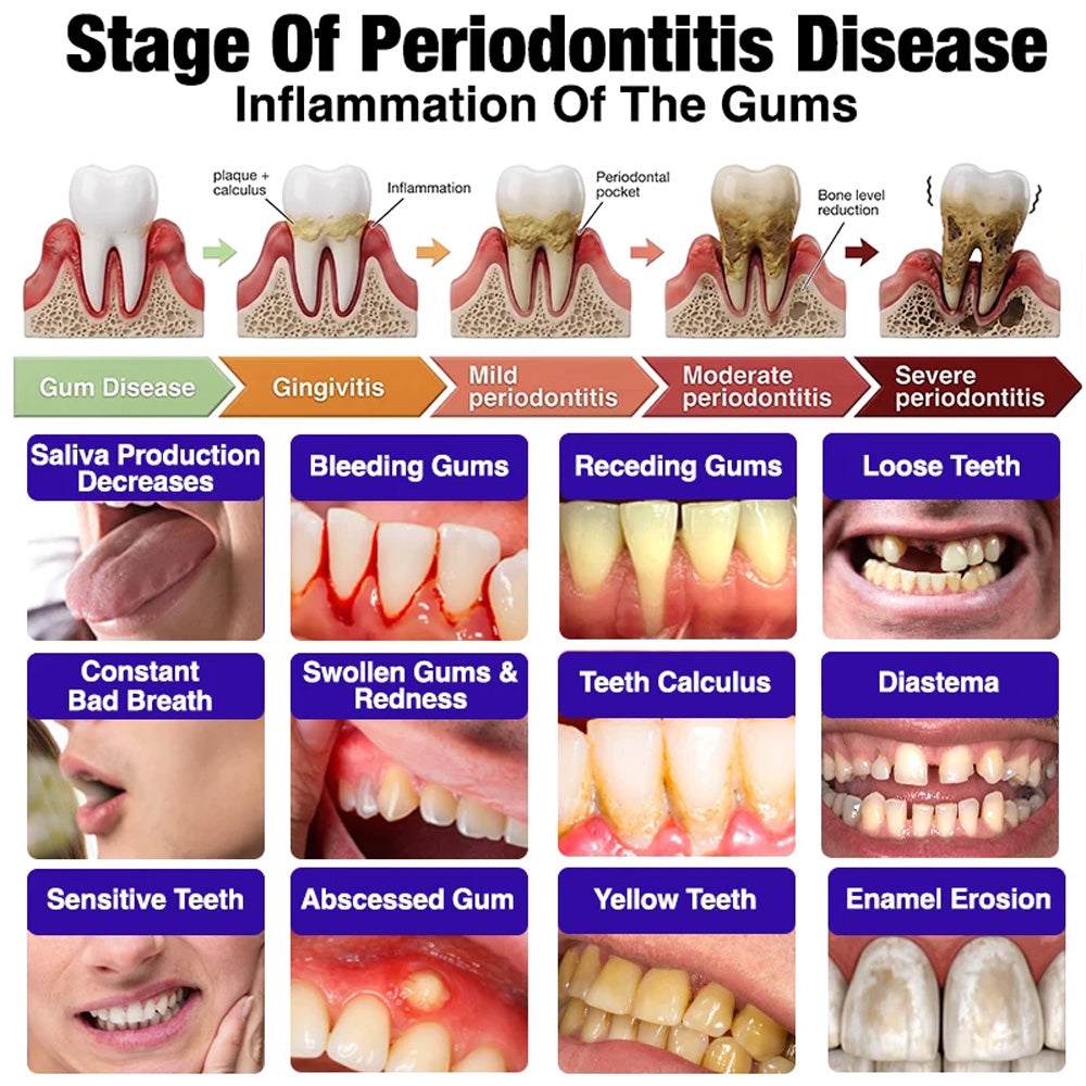 Purelora® VioGum Gingivitis&Periodontal Rescue Gel
