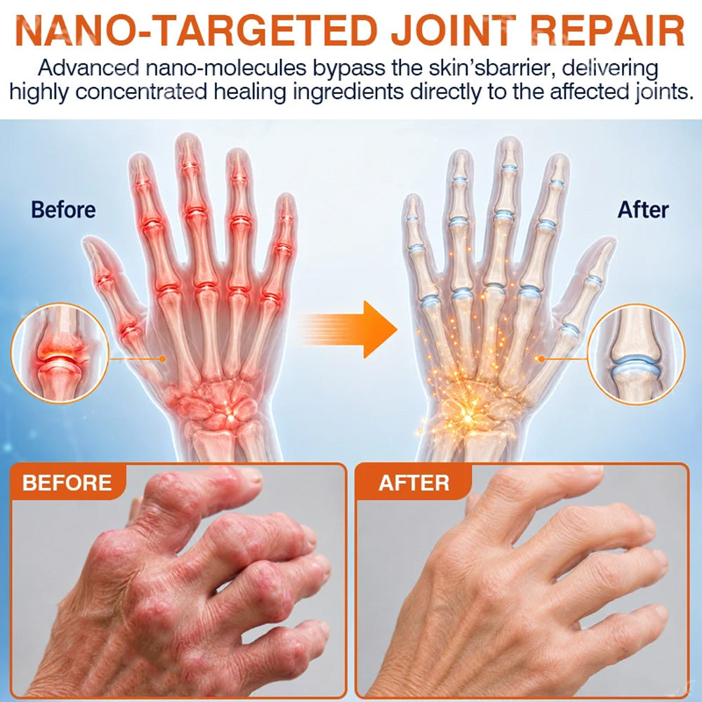 🦵✅🇬🇧 Advanced Micro-Delivery Technology:Purelora® Pain-Relief Bone-Healing Microneedle Patch